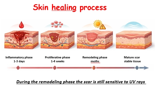 Stages of skin healing from inflammation to a mature scar